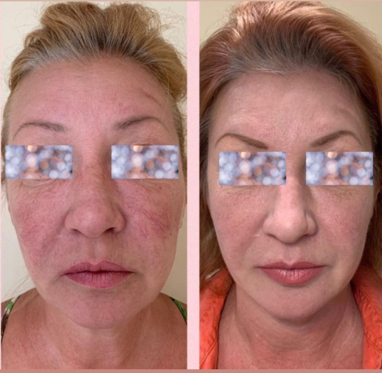 whatsapp image 2026 04 14 at 17.41.00